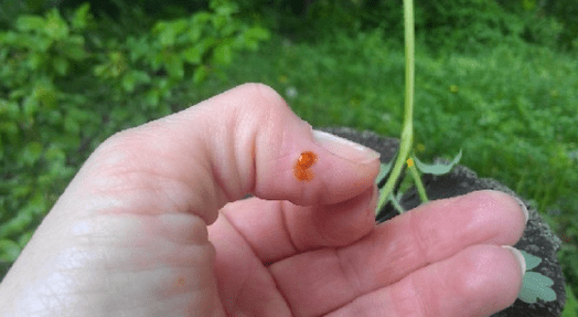 Celandine contro il papilloma