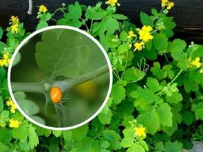 succo di erbe celidonia per il trattamento delle verruche plantari